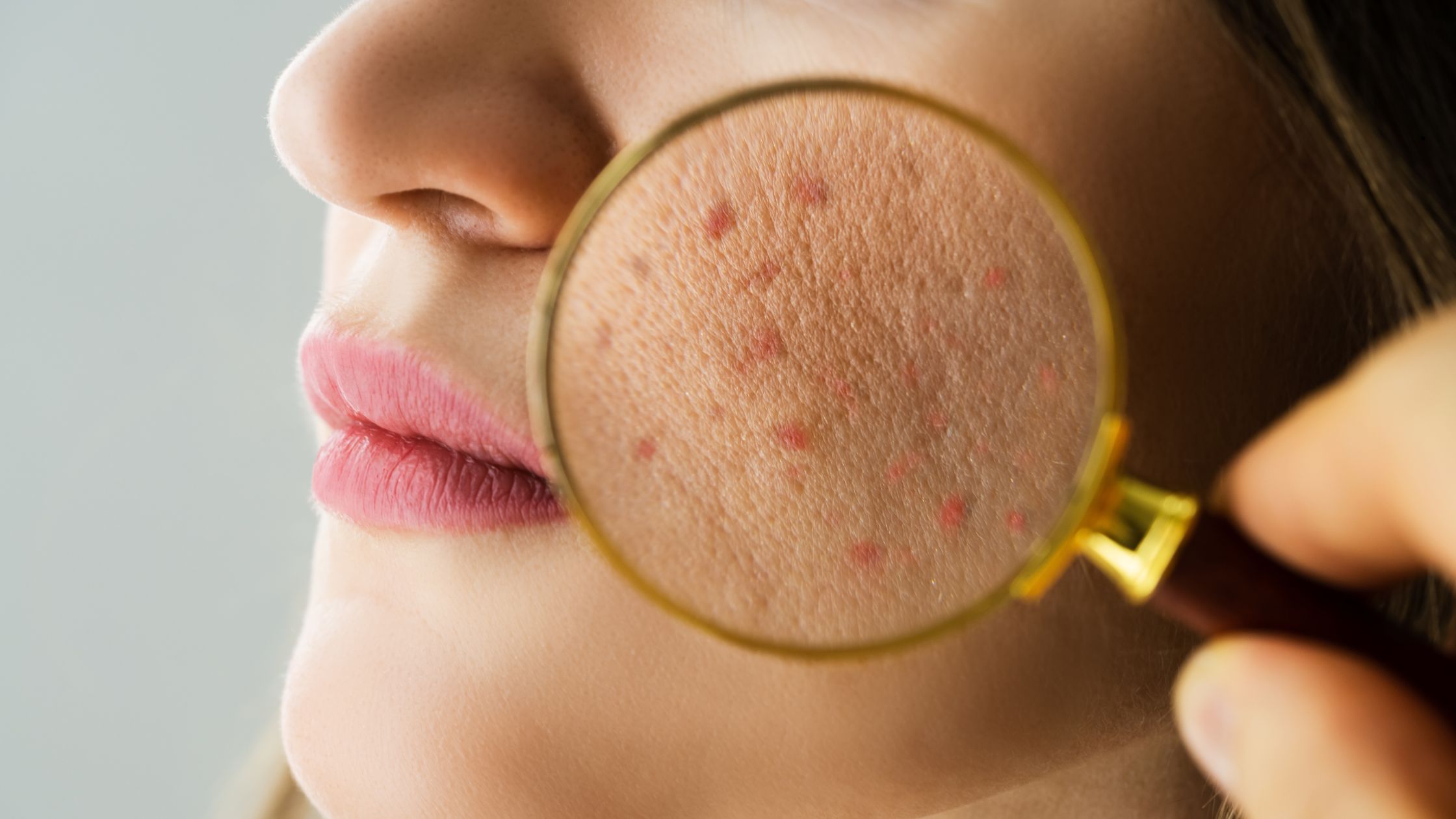 Skin microbiome and the hammam