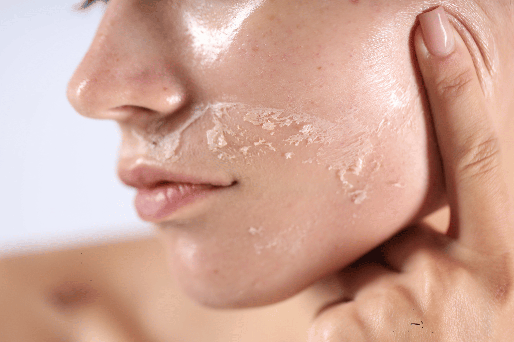 Why Dead Skin Releases So Easily After Hammam